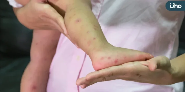 OPEN現身萬芳醫院陪童過節 洗手操防腸病毒寓教於樂