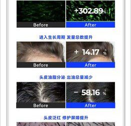 晶泰科技AI破局生發難題，「雙子星」新分子聯用引領突破性效果