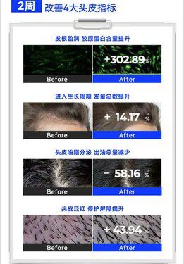 晶泰科技AI破局生發難題，「雙子星」新分子聯用引領突破性效果