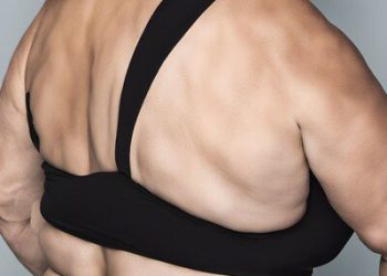 康霈 CBL-514 竇根氏症二期成果獲登國際權威期刊《JAAD International》