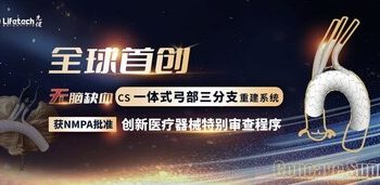 第17個創新綠色通道！先健CS一體式弓部三分支重建系統進入創新醫療器械特別審查程序